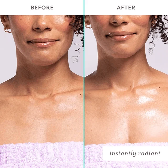 Before and after comparison of a woman's neck with a product application, labeled 'instantly radiant'.